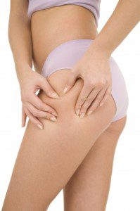 tips para evitar la celulitis,remedios para evitar la celulitis